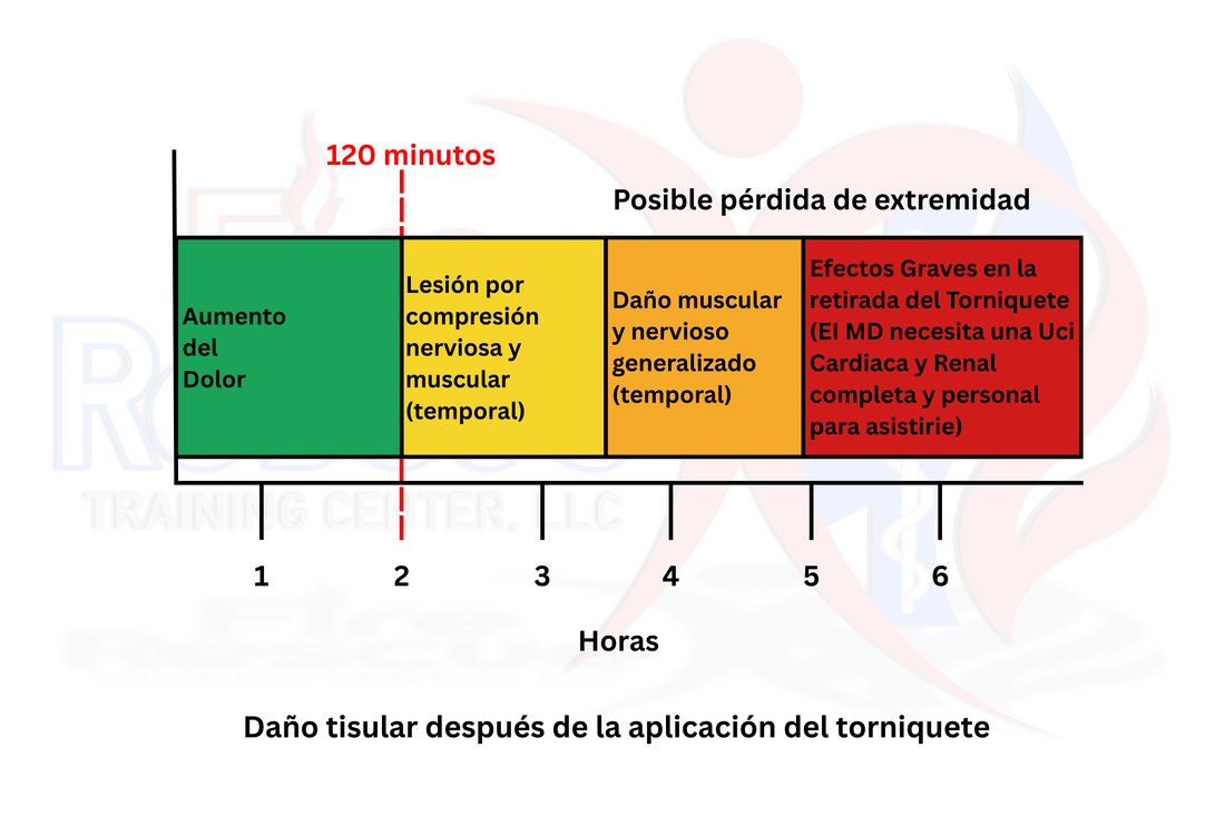 ¿Cuánto tiempo debe estar puesto un torniquete?
