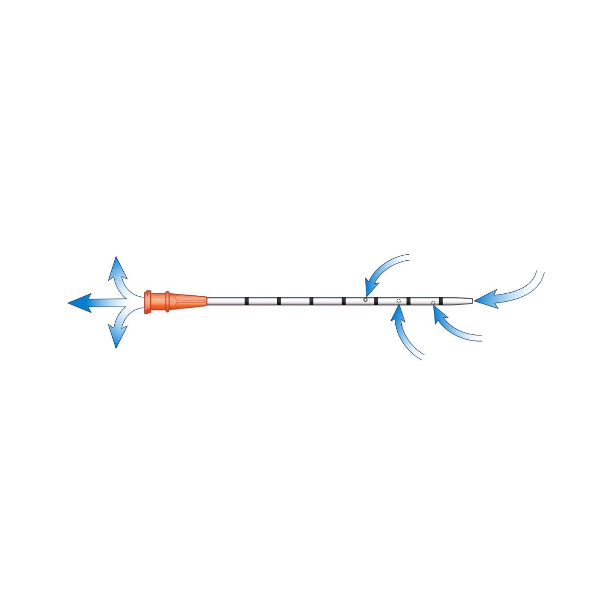 Enhanced ARS For Needle Decompression (14 gauge x 3.25 in.)